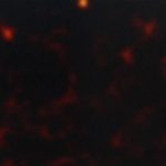 PHS0025