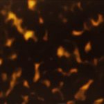 PHS0027